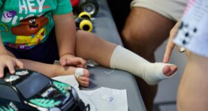 “No más fuegos artificiales”: Minsal se une a COANIQUEM en campaña preventiva de fin de año