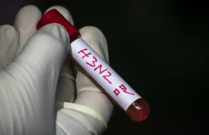 Minsal informó la detección de subclado K de influenza A(H3N2) en Chile